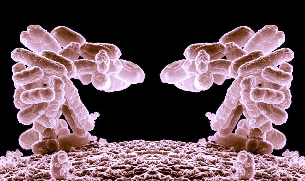Esta imagen de microscopio electrónico de barrido muestra estructuras microscópicas que parecen ser vellosidades intestinales: las proyecciones en forma de dedo que recubren el intestino delgado. Las superficies rosadas, muy plegadas, son características de estas estructuras absorbentes que aumentan la superficie de absorción de nutrientes.